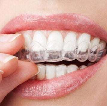 Dental Silicone Aligners Tray – Thermoplastic Moldable Trays for Whitening (6-Pack)