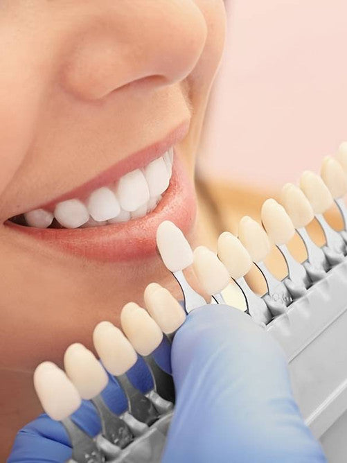 Dental Teeth Shade Chart