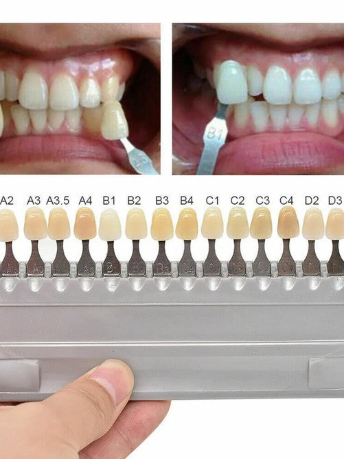 Dental Teeth Shade Chart