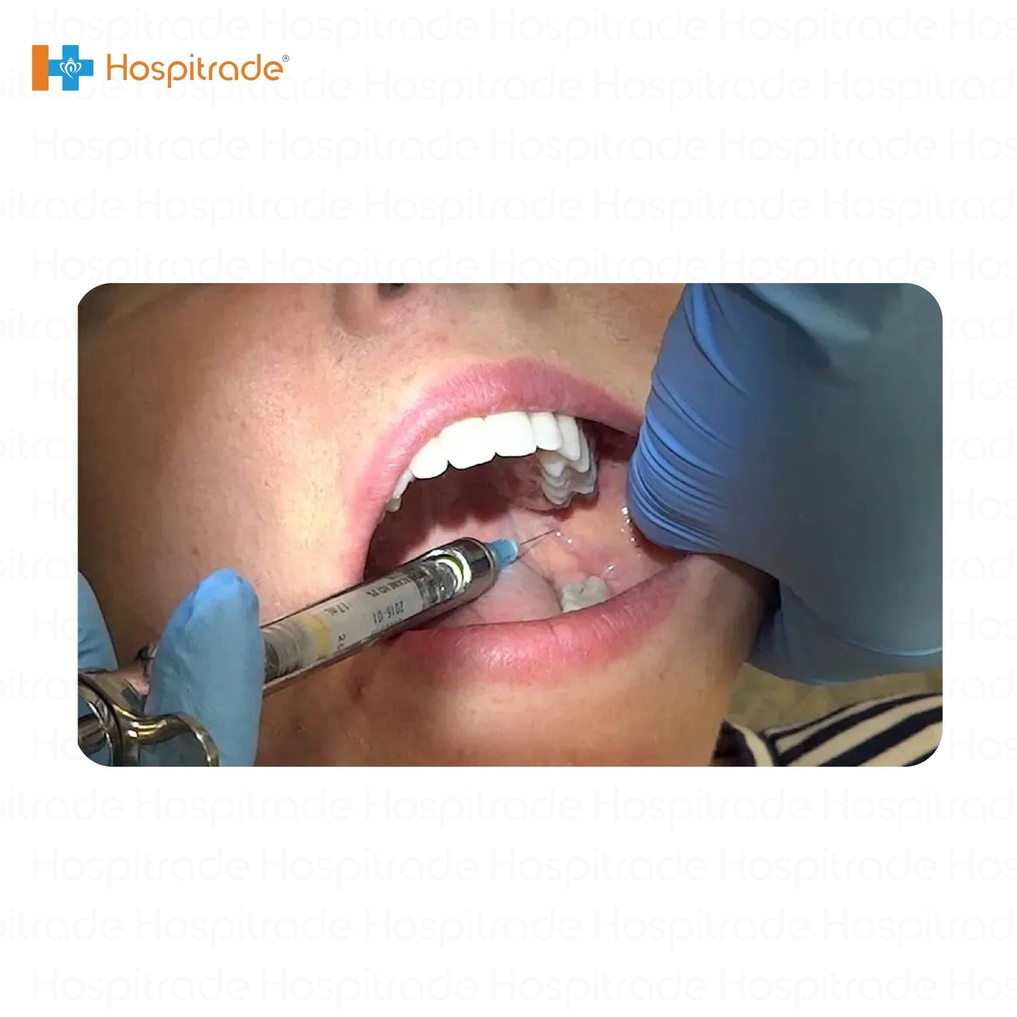 Dental Anaesthetic Syringe – 1.8ml Three-Finger grip | Autoclavable for Precision Injections