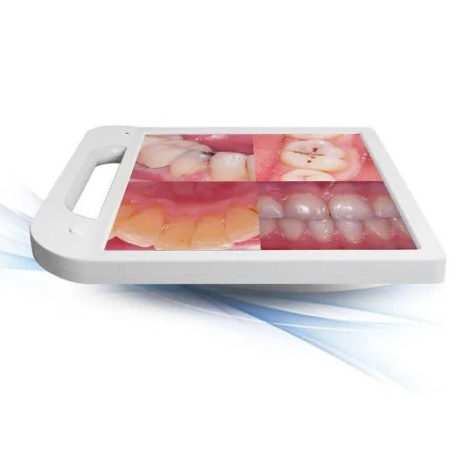 Advanced Intraoral Camera System for Dentistry: High-Resolution Mouthwatch Dental Camera with LED Lighting and 17-Inch Screen