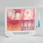 Advanced Intraoral Camera System for Dentistry: High-Resolution Mouthwatch Dental Camera with LED Lighting and 17-Inch Screen