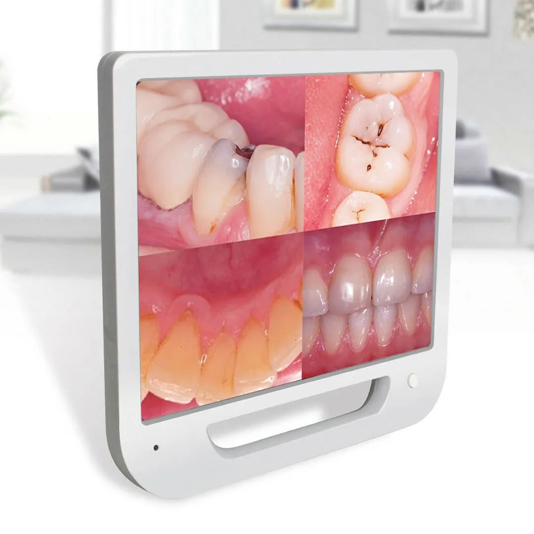 Advanced Intraoral Camera System for Dentistry: High-Resolution Mouthwatch Dental Camera with LED Lighting and 17-Inch Screen