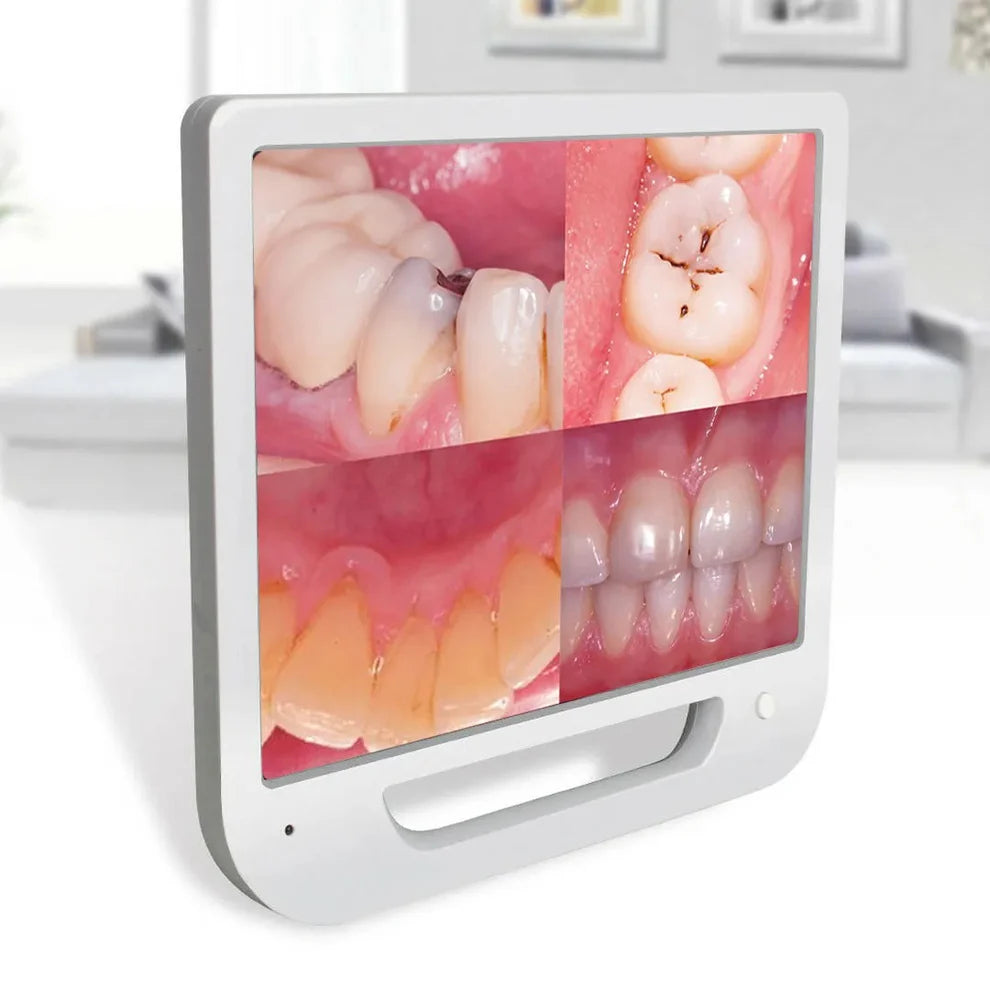 Intraoral Camera – HD WiFi Dental Imaging Device | Wireless | Manual Included | UK Clinics