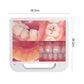 Advanced Intraoral Camera System for Dentistry: High-Resolution Mouthwatch Dental Camera with LED Lighting and 17-Inch Screen