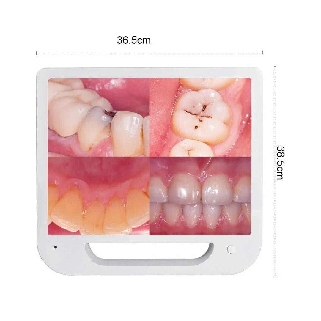 Advanced Intraoral Camera System for Dentistry: High-Resolution Mouthwatch Dental Camera with LED Lighting and 17-Inch Screen