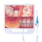 Advanced Intraoral Camera System for Dentistry: High-Resolution Mouthwatch Dental Camera with LED Lighting and 17-Inch Screen